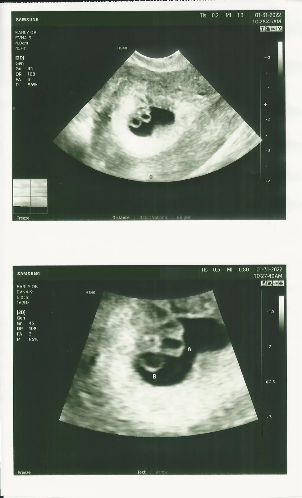 60 - ultrasound.webp