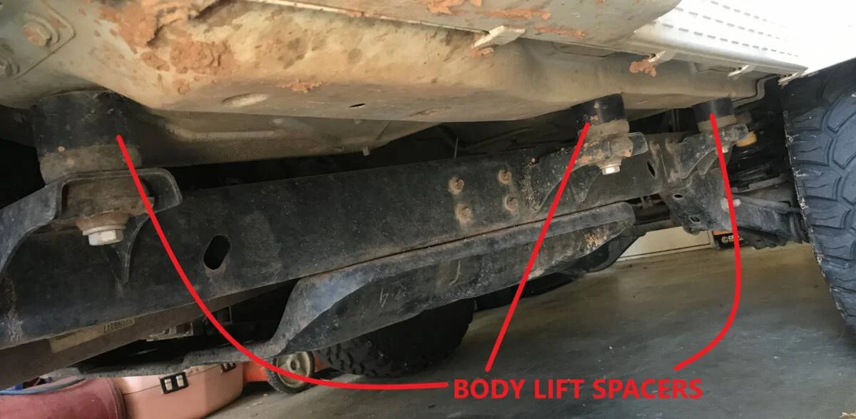 Body-Lift.webp