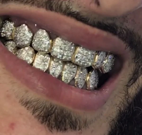 chrome grill.webp
