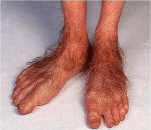 Hairy Feet.webp
