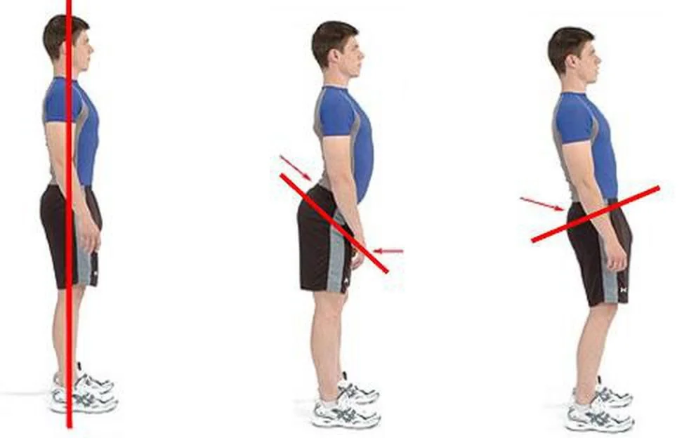 https___prod.static9.net.au___media_2016_11_15_16_09_postures-161115.jpg